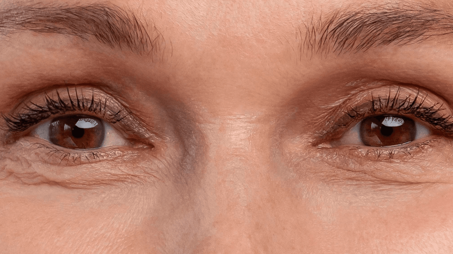 After 4 weeks of use