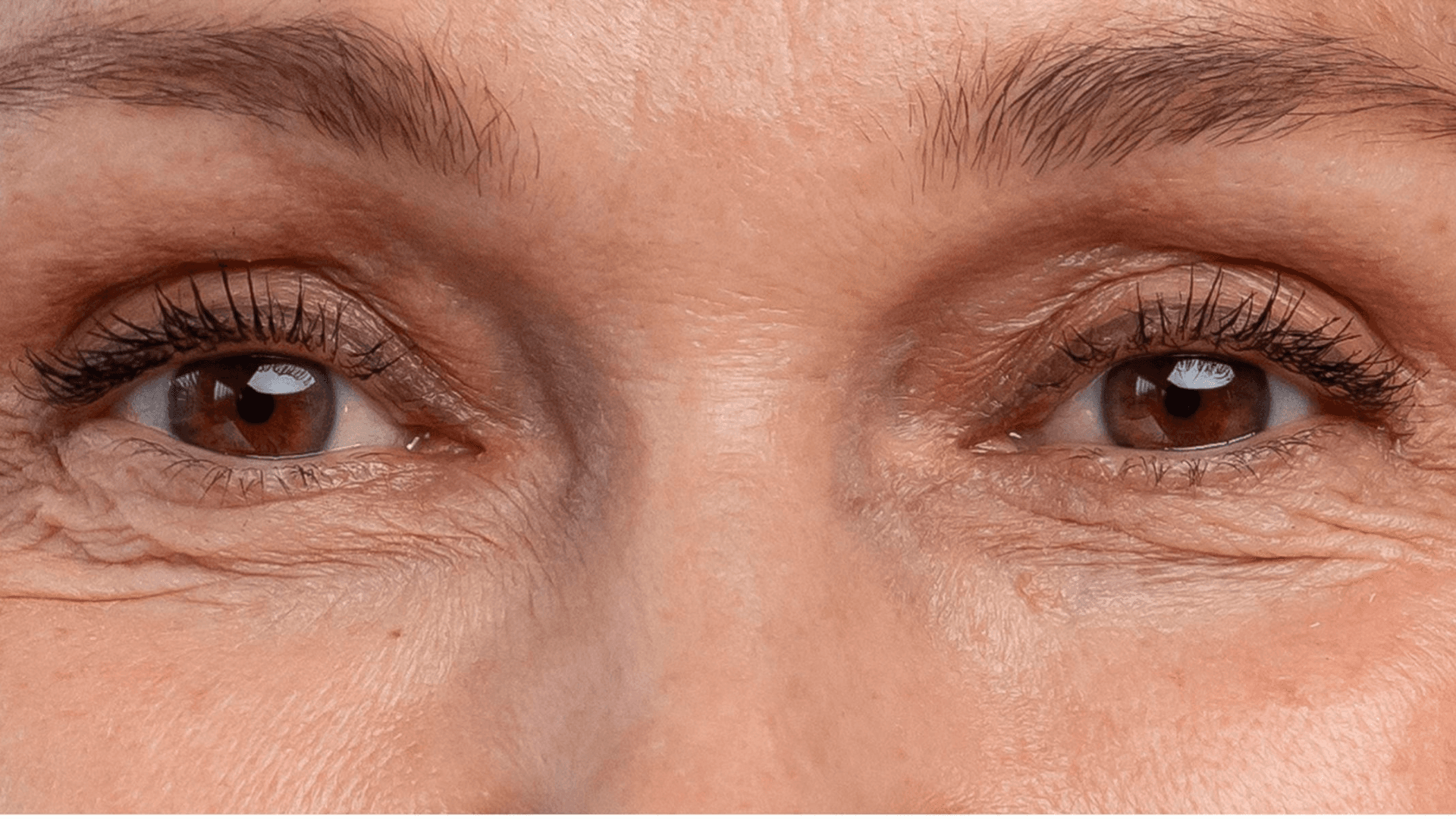 Before starting treatment