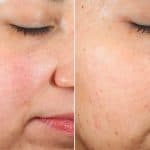 Sensitive & Redness Skin